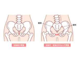 妊娠後の骨盤